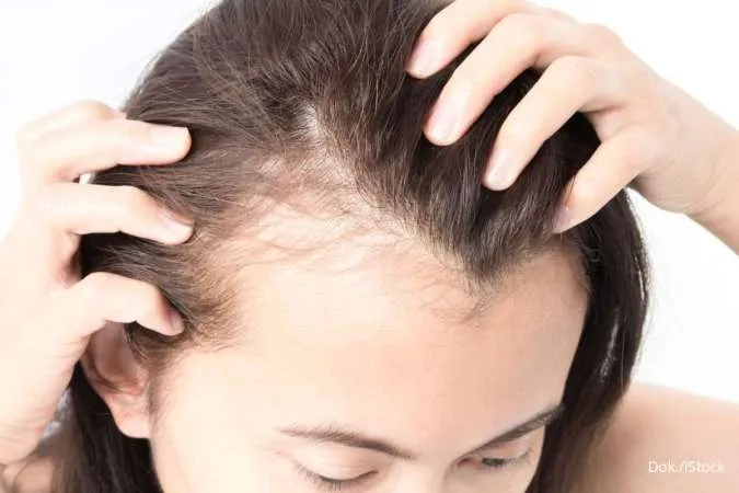 7 Hair Oil Alami untuk Rambut Tipis, Gunakan Secara Rutin!