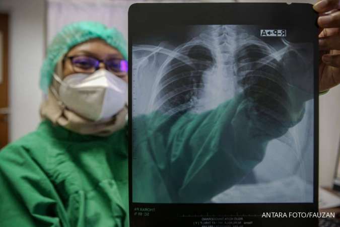 Penyakit TBC Bisa Jadi Penyumbang Angka Kemiskinan di Indonesia, Ini Sebabnya