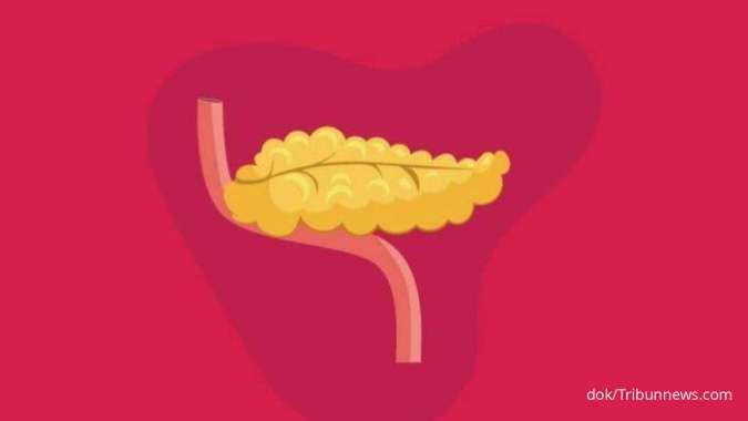 Penyebab Kanker Pankreas