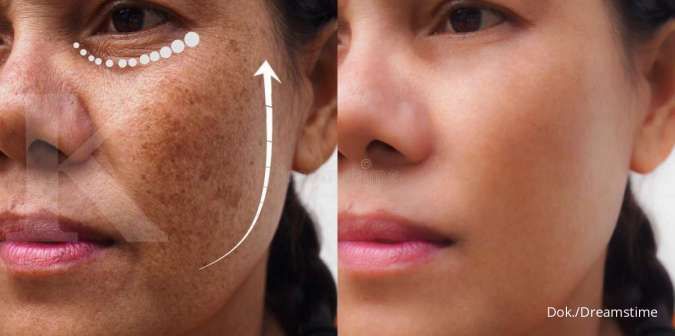 6 Kebiasaan Ini Ternyata Bisa Merusak Kulit Wajah Lho. Yuk, Stop Sekarang Juga!