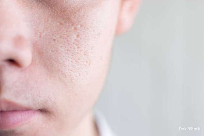 4 Kesalahan Skincare Penyebab Pori-Pori Semakin Besar, yuk Perbaiki