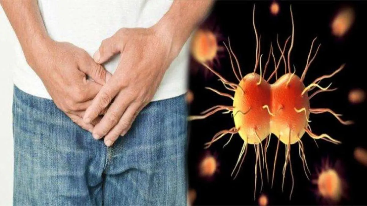 Bersifat Menular, Ini Penyebab dan Gejala Gonore