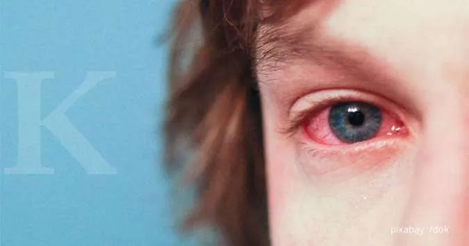 Penyebab Mata Merah pada Anak dan Cara Mengatasinya