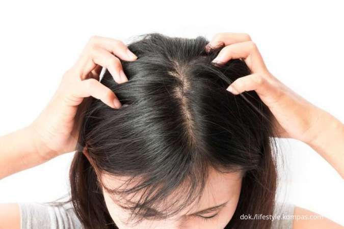 Jerawat di Kepala Bikin Enggak Nyaman? Ini Cara Ampuh Mengatasi Folikulitis