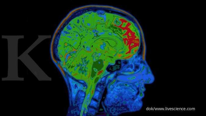 Studi Terbaru Ini Beri Peringatan: Covid-19 Bisa Sebabkan Otak Menyusut