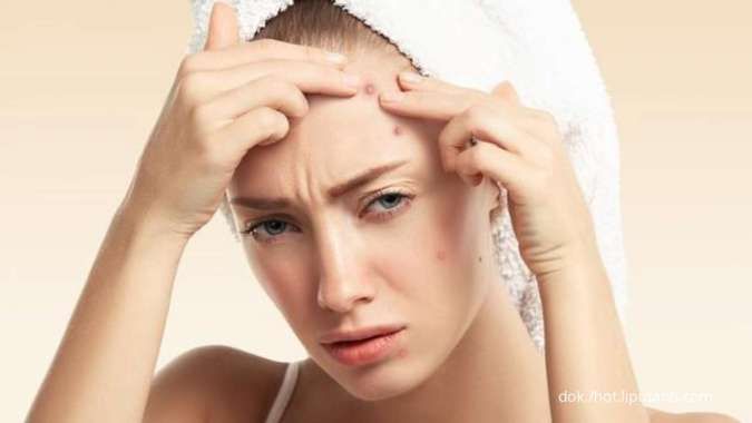 Kulit Gampang Jerawatan? Ini 5 Kandungan Skincare untuk Merawat Kulit Acne-Prone