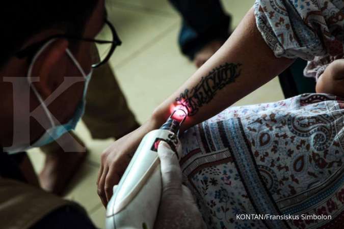 Perhatikan Hal Ini Dulu Sebelum Menghapus Tato 