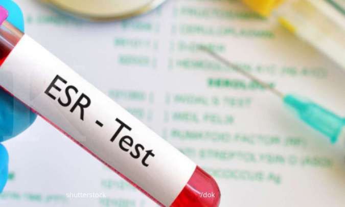 Kenali Penyebab Laju Endap Darah Meningkat