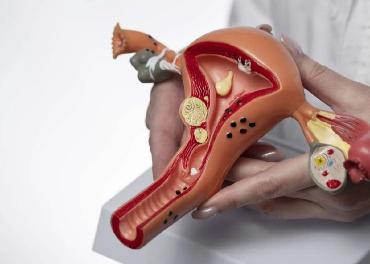 Ini Syarat untuk Tes HPV DNA Gratis untuk Deteksi Kanker Serviks di Puskesmas Jakarta