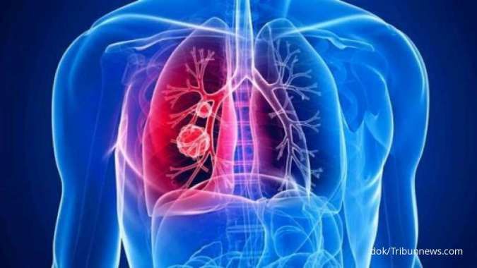 cara mencegah kanker paru-paru