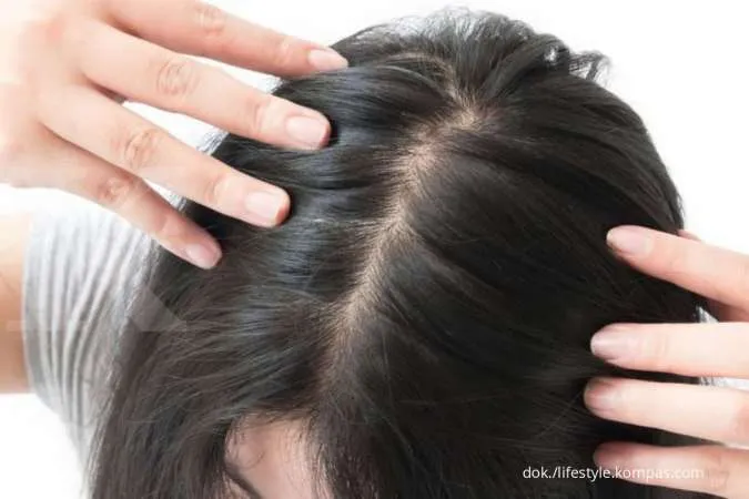 Inilah 5 Cara Cepat Menumbuhkan Rambut dengan Bahan Alami