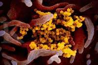 Rumor terinfeksi Covid-19, Presiden Tanzania meninggal di usia 61 tahun