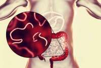 Rawan Dialami Si Kecil, Begini Cara Mencegah Infeksi Cacing Kremi, Moms!