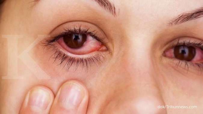 Penyakit mata dan telinga bisa dialami pasien Covid-19