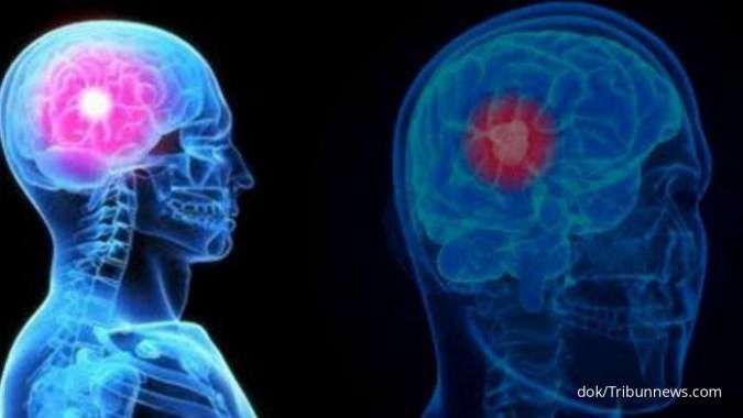 Tumor Otak: Penyebab dan Gejalanya 