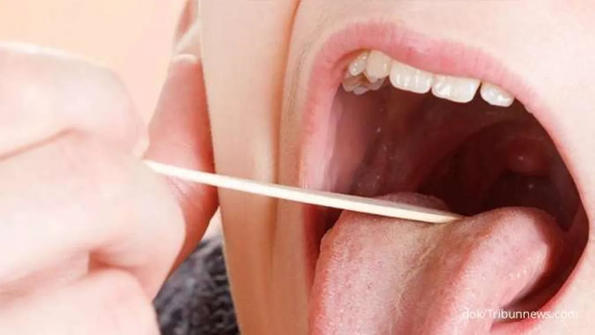 Selain Sulit Menelan, Ini Gejala Radang Amandel yang Sering Muncul 