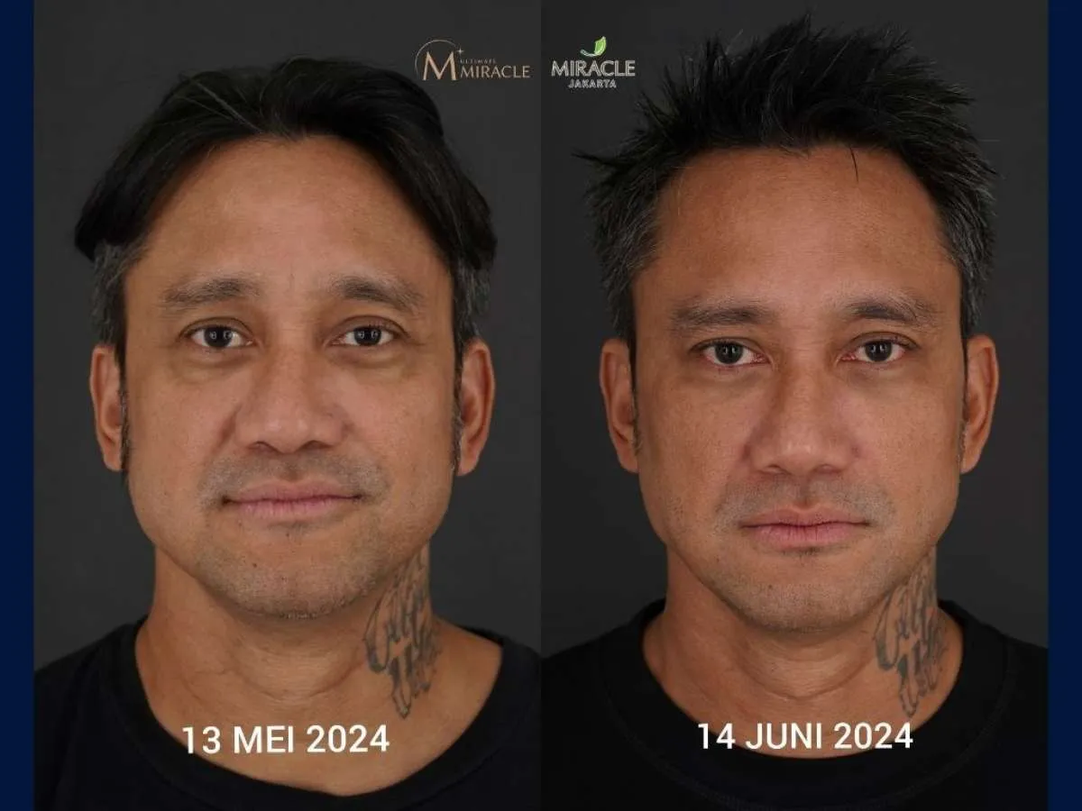 Miracle Luncurkan MIRACLE AI-Architectural Intelligence,Teknik Kunci Hasil Natural