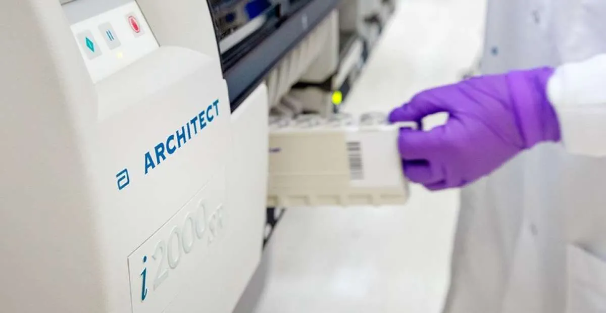 Pemerintah tingkatkan kapasitas pemeriksaan, Abbot sediakan alat tes Covid-19 canggih