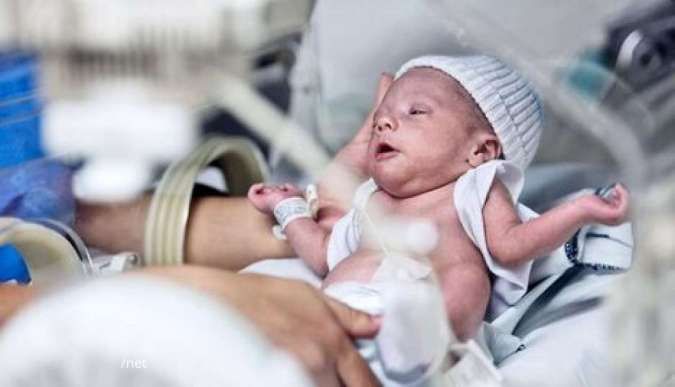 Punya Anak Lahir Prematur? Harus Lakukan Pemantauan Sesering Mungkin