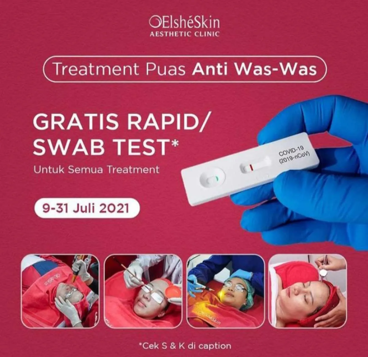 Promo Treatment Kecantikan di ElsheSkin Clinic, Gratis Rapid atau Swab Test!