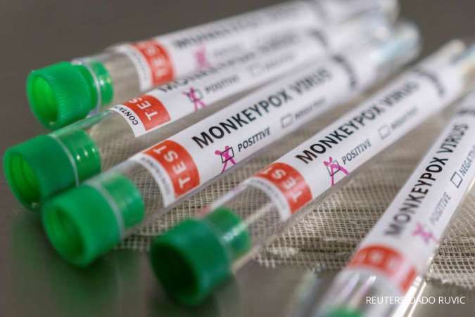 WHO: Tak Perlu Vaksin, Cacar Monyet Bisa Dikendalikan 