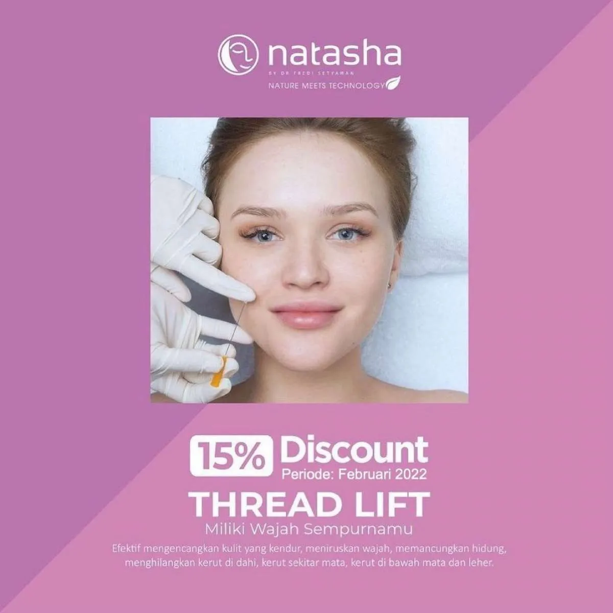 Manfaatkan Promo Natasha Thread Lift Diskon 15% Ini untuk Mengencangkan Kulit Wajah