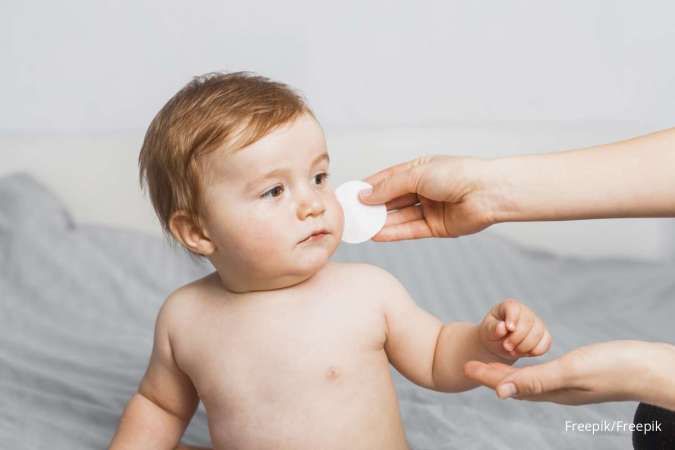 5 Cara Mengatasi Biang Keringat pada Bayi dan Waktu yang Tepat untuk ke Dokter