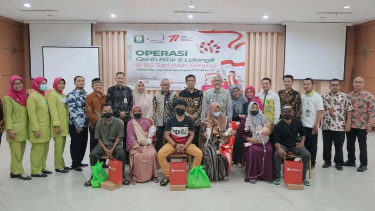 Bank Banten Berikan Operasi Bibir Sumbing Gratis Kepada Masyarakat Banten