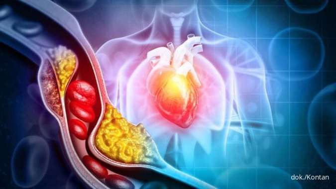8 Mitos tentang Kolesterol yang Tidak Perlu Dipercaya