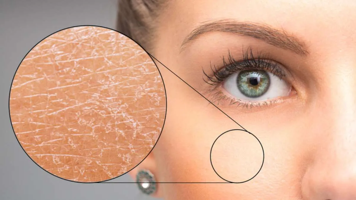 4 Ciri-Ciri Kulit Dehidrasi dan Cara Mengatasinya dengan Tepat, Cari Tahu Yuk!