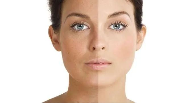 4 Penyebab Kulit Belang Meski Sudah Pakai Sunscreen, Catat Ya!