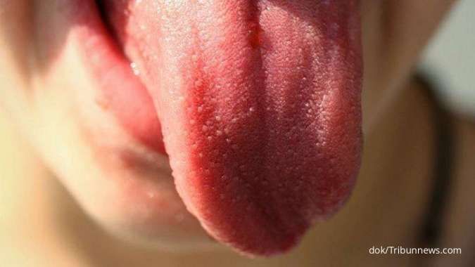 Cara menghilangkan pahit di mulut saat sakit