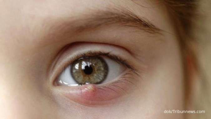 Moms Wajib Tahu Nih, Ini Cara Efektif Menjaga Kesehatan Mata Anak