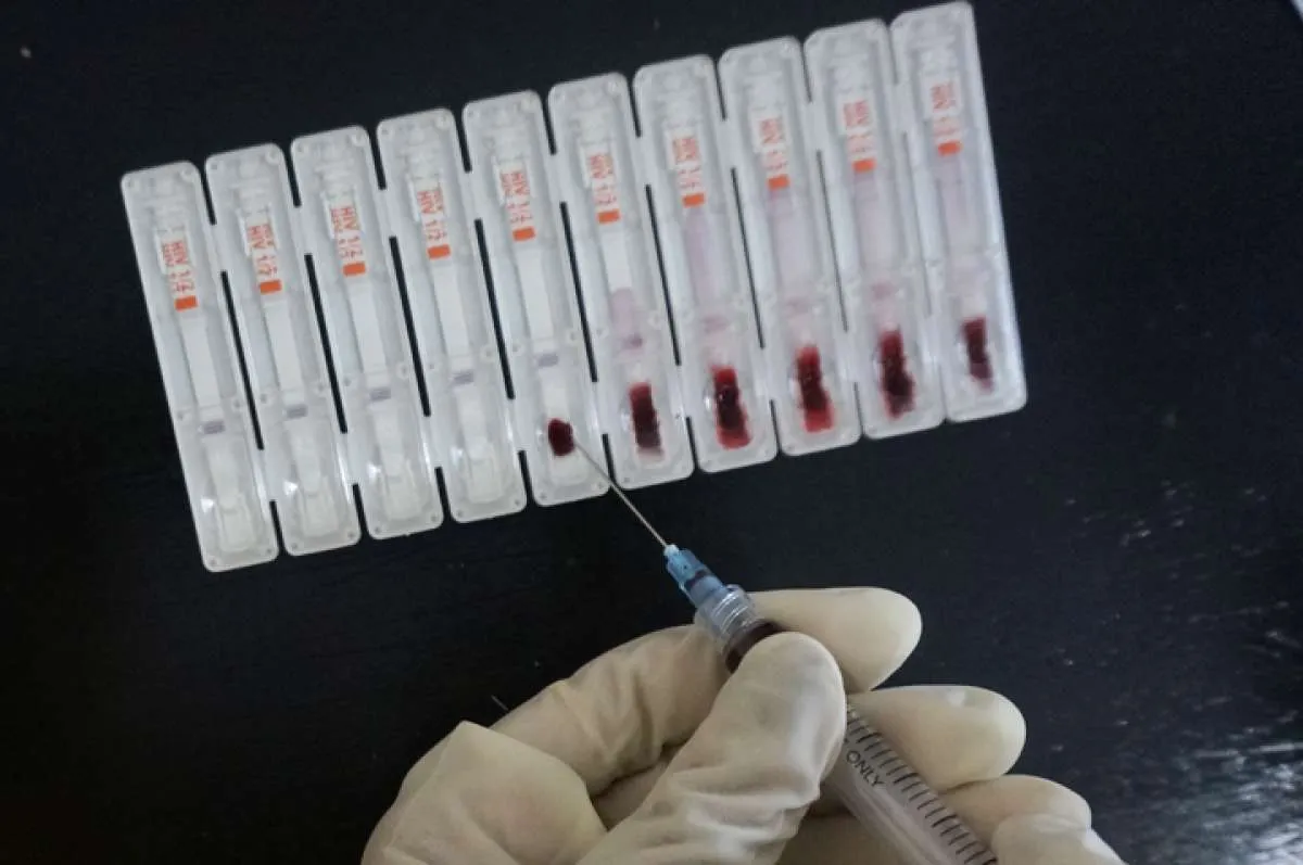 Semua orang termasuk yang tidak berisiko sebaiknya lakukan tes HIV, kapan?