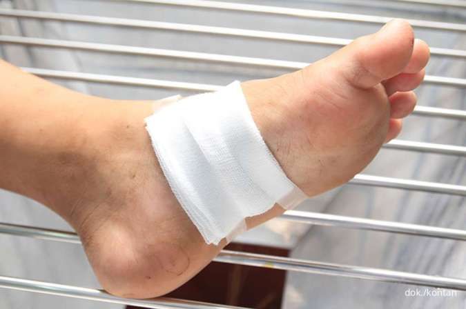 Perhatikan, Begini 8 Ciri-ciri Luka Diabetes Mau Sembuh
