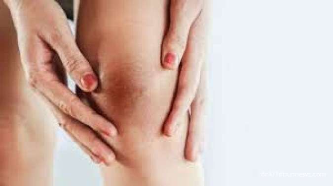 6 Bahan Alami yang Efektif Mencerahkan Lutut Hitam 